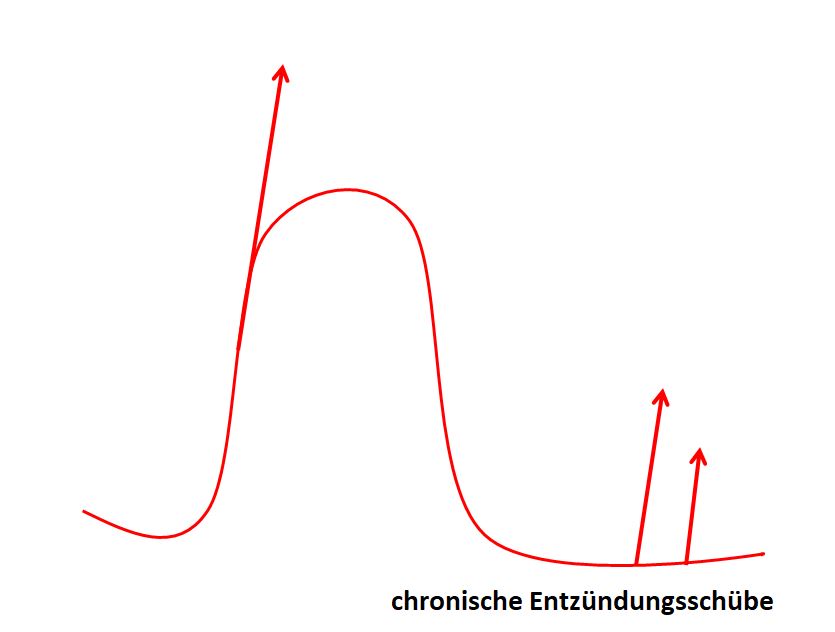 Entzuendung Hashimoto2